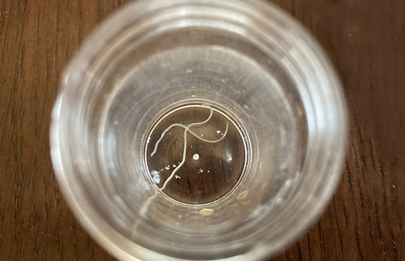 アニサキス症